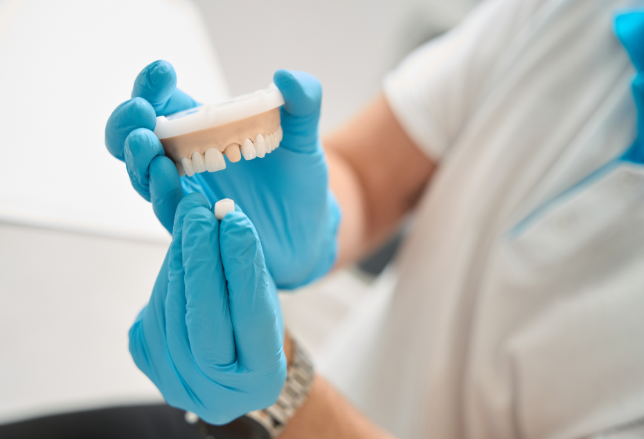 Dentist holding model teeth with crown